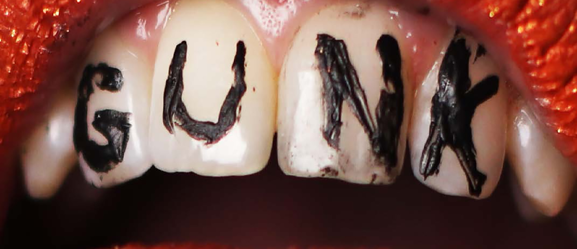 Image shows teeth, with the word 'GUNK' wrote on them in black make-up